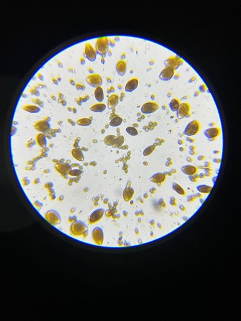 Dinoflagellates. Ostreopsis 8.28.22.jpg