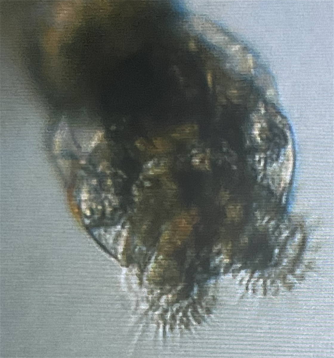 Rotifer1.png