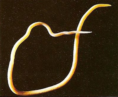 Ascaris_lumbricoides.jpg