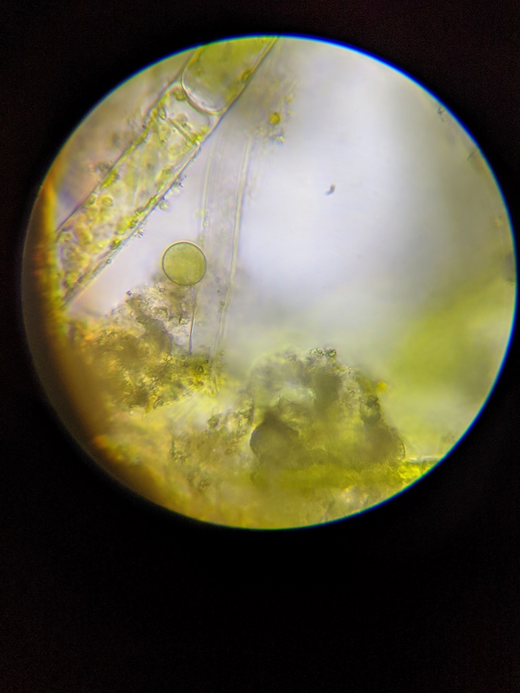 Algae under microscope